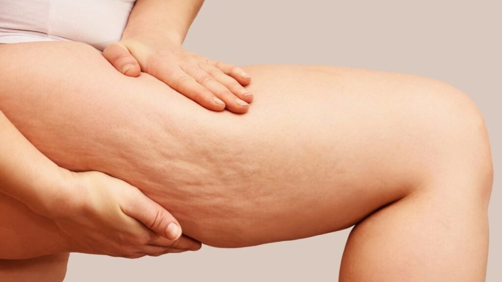 Qual é o melhor creme para celulite? os 10 melhores em 2024 1 Melhor creme para celulite